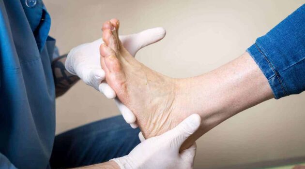Need to Take Novel Care of Their Feet – Know the Properties